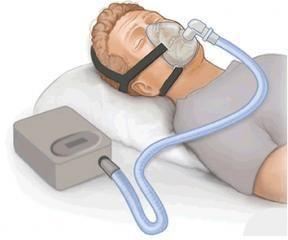 医用CPAP质量流量传感器模块 FS6122系列