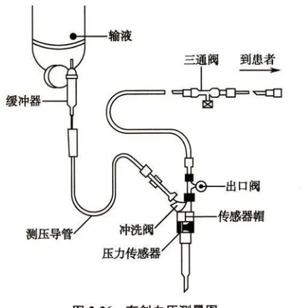 用于医疗器械导管内液体压力测量的光纤压力传感器